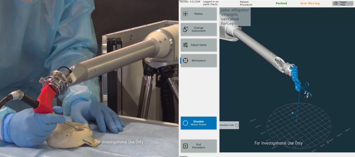 Galen Robotics looks to assist ENT surgeons with new bot and $15M round • ZebethMedia